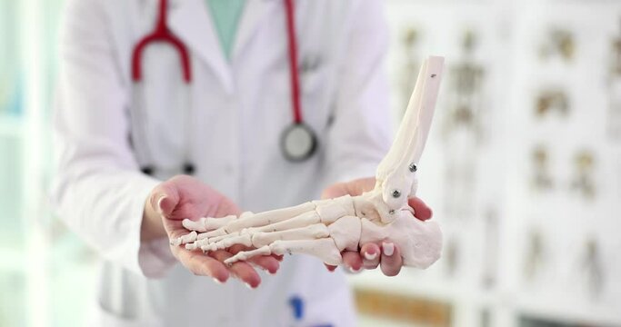Orthopedic doctor looks at ankle and arthrosis of te lower extremities