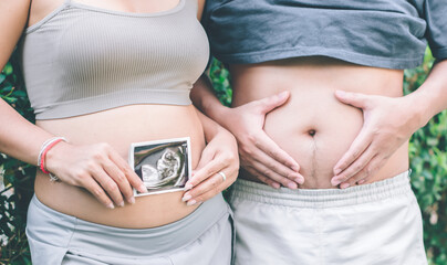 man and woman holding a pregnant woman