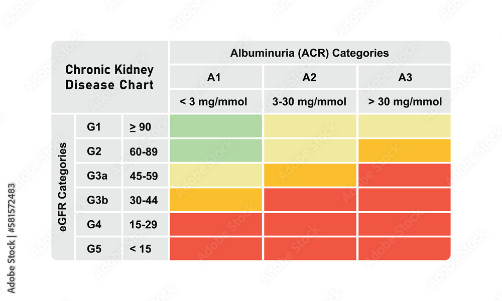 Wall mural Scientific Designing of Chronic Kidney Disease (CKD) Stages. Vector Illustration. - Wall murals