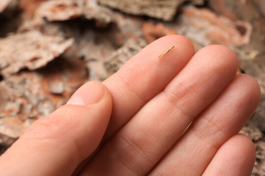 Woman with splinter in her finger on blurred background, closeup