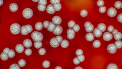 checking the sanitary cleanliness of hospital wards growing a microphone in petri dishes