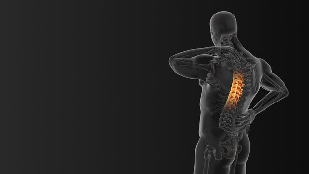 Cervical vertebral pain medical animation
