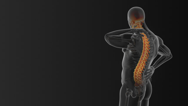 Neck and back joint pain medical concept