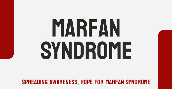 Marfan Syndrome - Genetic Disorder Affecting The Connective Tissue.