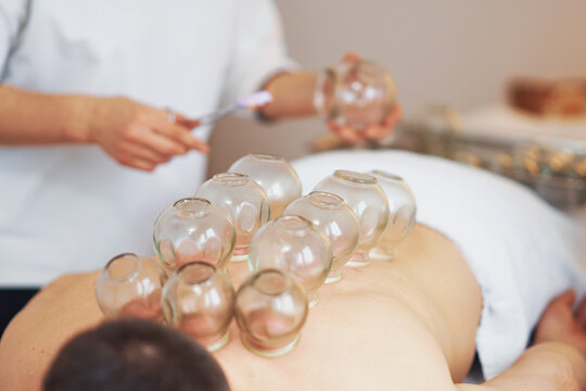 Cupping Individual Cupping Man Images – Browse 696,535 Stock Photos, Vectors, and Video ...
