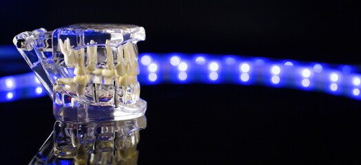 Dental jaw model over black background. Transparent invisible dental aligners or braces aplicable for an orthodontic dental treatment