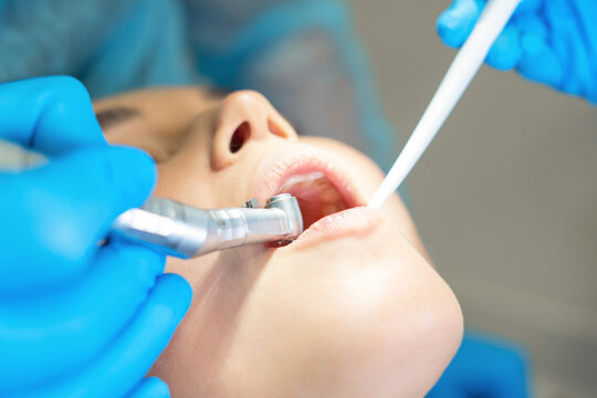 Closeup photo of male dentist with female patient in dental chair providing oral cavity treatment.