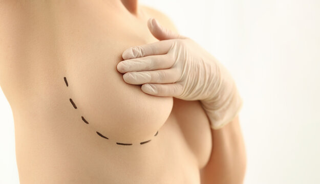 Beautiful woman covering breasts with black surgical lines