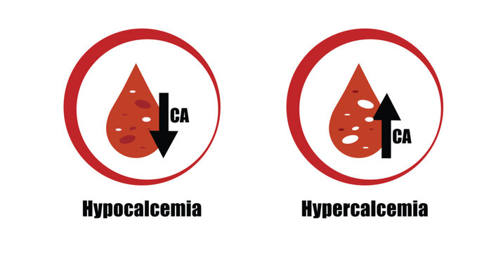 Hypocalcemia and hypercalcemia vector. Round icion