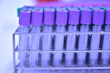 Tubes for collecting blood in medical laboratories. science concept medical