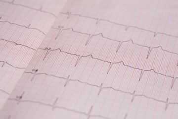 Close-up of the Electroencephalogram graph on a pink paper