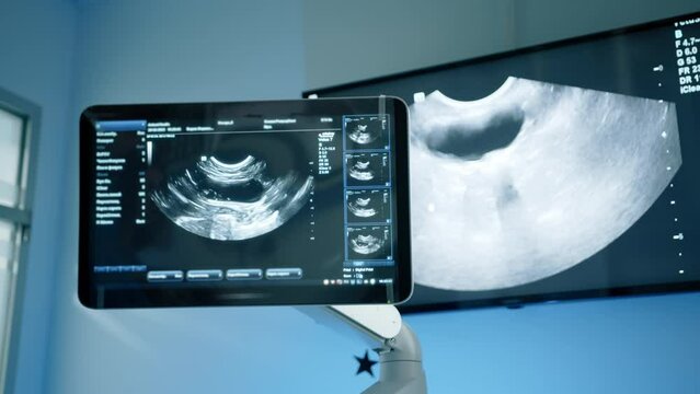 Camera showing the monitor of a ultrasound machine and movement on the screen. It is showing the doctors what might be bothering the pet. High quality 4k footage