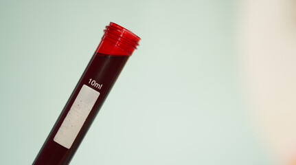 Banner. A test tube with blood with a space for copying on a light background. Transparent test tubes with red contents and a label for data identification. Selective focus. High quality photo