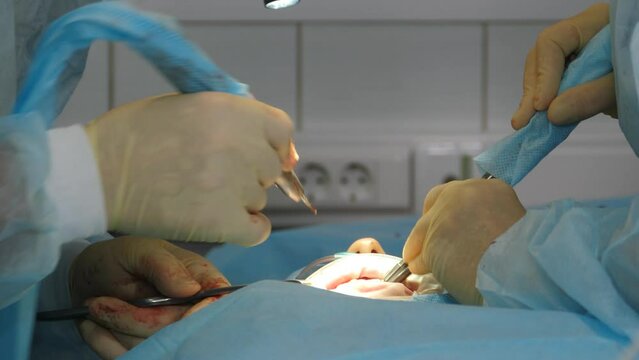 Modern dental clinic. Professional dentist surgeon treating root canals, extracting tooth or installing dental implants. Doctor and assistant wear protective suit and gloves. 4 k video