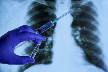 a hand in a blue medical glove holds a syringe and ampoule with medicine against the background of an X-ray of the lungs
