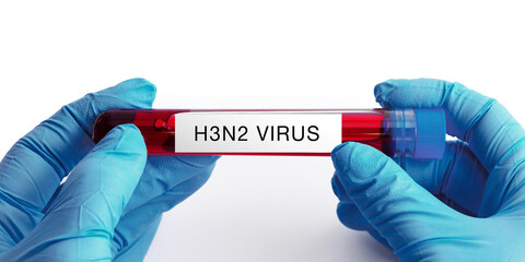 H3N2 virus. Close-up of a scientist's hand with a sample of the H3N2 virus on white background. 