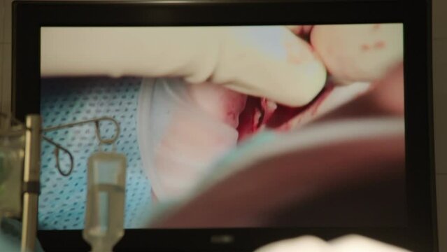 Medical and dental surgery on the monitor in the operating room in real time.