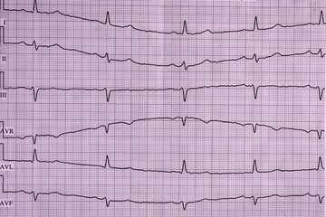 Cardiogram. Heart beat. Heartbeat line. Electrocardiogram. 