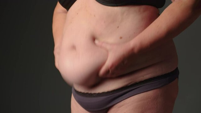 Woman with belly fat. Obesity in older women. Fat female belly, woman holding skin to check cellulite. Flabby skin on a fat belly, plastic surgery concept on gray background