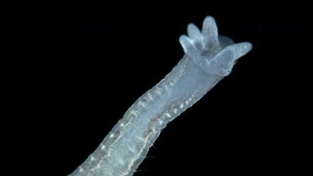 Aulophorus sp worm under a microscope, family Naididae. Lives in water contaminated with organic residues. At the end has gills similar to tentacular appendage.