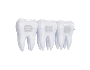 Teeth ceramic braces. Teeth alignment. Three white teeth with braces on a transparent background. PNG. 3d render