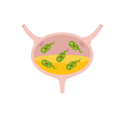 Virus in the bladder. Infection and inflammation