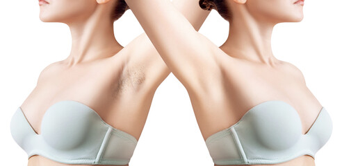 Woman's armpit with before and after epilation.