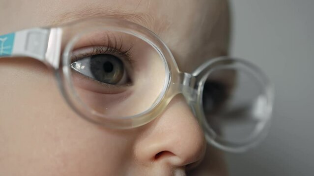 Close-up eye and pupil of infant with glasses. Caucasian baby with strabismus is watching TV at home. Poor eyesight or bad vision. White kid has an eye disease, squint. Eyeglass frames on small child