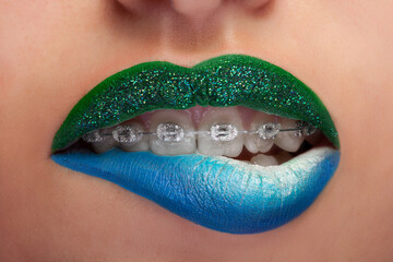 Close up mouth blue and green lips with glitter brackets. Fashion make up. Make up addiction....