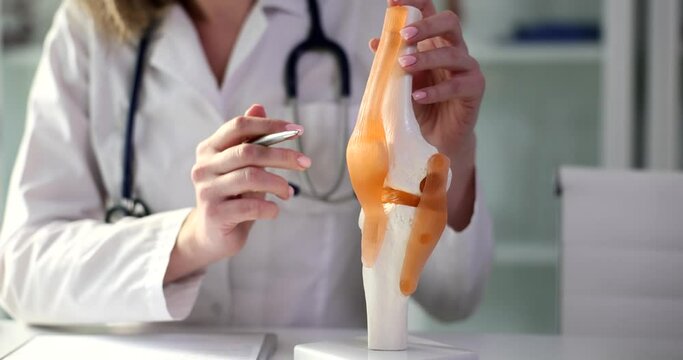 The doctor shows a knee model with tendons