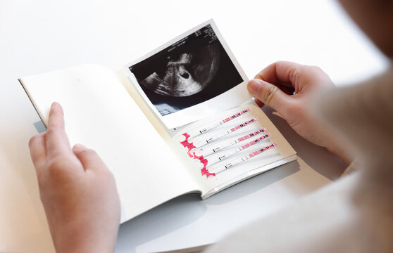 A pregnant woman attaches an ultrasound picture of her child to the Fragnancy Diary