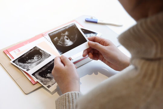  A pregnant woman attaches an ultrasound picture of her child to the Fragnancy Diary