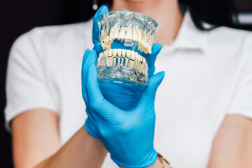 Dental demonstration model of the jaw in the hands of a surgeon.