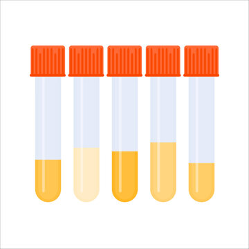 Urine sample in test tubes showing dehydration level. Yellow specimen liquid containers. Laboratory equipment. Medical concept. Vector illustration.