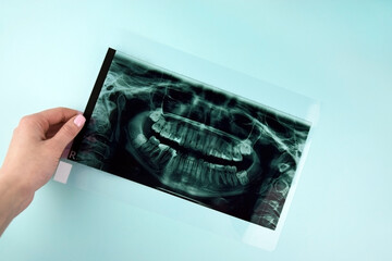A dentist holding snapshot the patient's tooth.