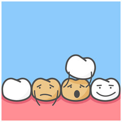 Smile makeover, dental ceramic veneers, row of cute cartoon teeth covering with veneers, vector