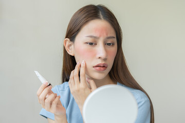 Dermatology, asian young woman looking at mirror, holding cream tube in hand, expression worry and itch, itchy allergy or allergic sensitive reaction, red or rash on face. Beauty care of skin problem