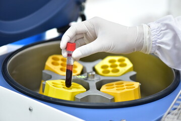 Scientist analyzing blood in the laboratory. Concept. Medical science laboratory. Health.