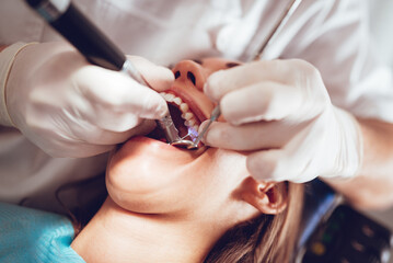 Repairing Teeth