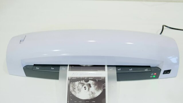 The plastic lamination machine spoils the document. The desktop laminator highlights the ultrasound result