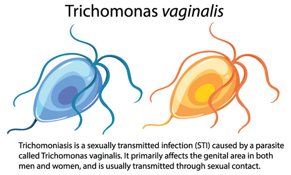 Trichomonas vaginalis with explanation