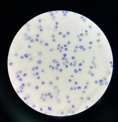 Reticulocytes are red blood cells that are still developing.