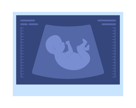 Fetal ultrasound picture semi flat color vector object. Pregnancy progress. Editable icon. Full sized element on white. Simple cartoon style spot illustration for web graphic design and animation