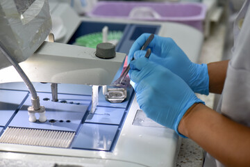 A pathologist is preparing a pathological biopsy for laboratory diagnosis of pathology.