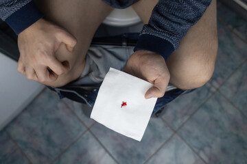 Hemorrhoid concept. A man sits on the toilet and holds white toilet paper in his hands. There is a...