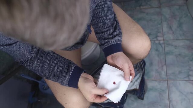 Hemorrhoid concept. A man sits on the toilet and holds white toilet paper in his hands. There is a little drop of blood on it. Aesthetic presentation of problems with the rectum.