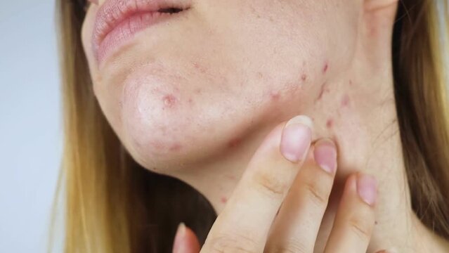 Hemorrhoid concept. A man sits on the toilet and holds white toilet paper in his hands. There is a little drop of blood on it. Aesthetic presentation of problems with the rectum.