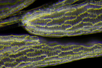 Microscopic view of peat moss (Sphagnum) leaves. Darkfield illumination.