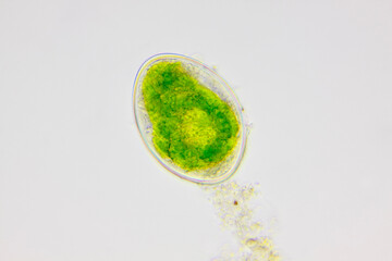 Microscopic view of freshwater green algae (Spirogyra) zygospore. Brightfield illumination.