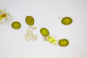 Microscopic view of freshwater green algae (Spirogyra) zygospores. Brightfield illumination.